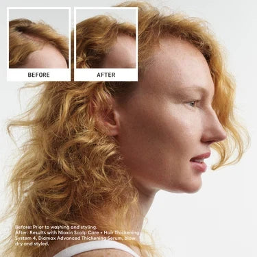Nioxin System 4 Conditioner 300ml - For Coloured Hair with Progressed Thinning